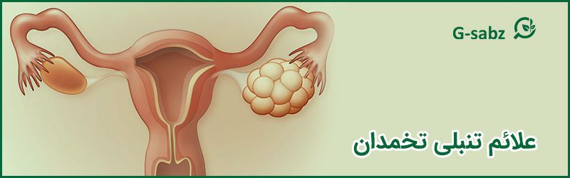 علائم تنبلی تخمدان