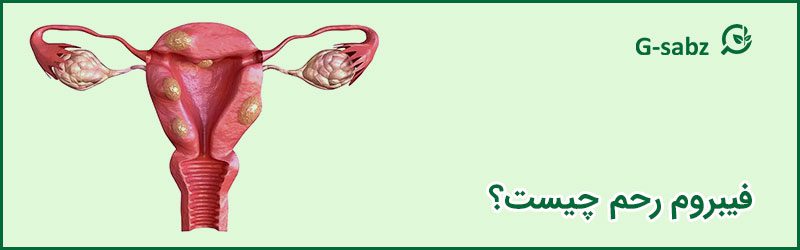 1 فیبروم رحم چیست